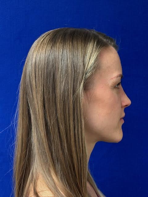 Profile of a woman with long straight hair against a blue background.