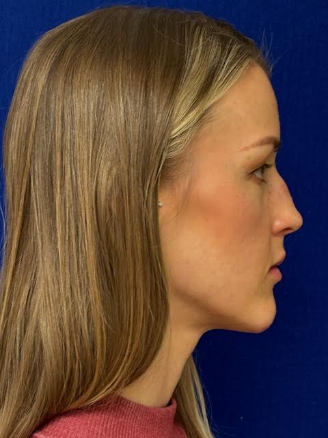 Profile view of a woman with long blonde hair against a dark blue background.